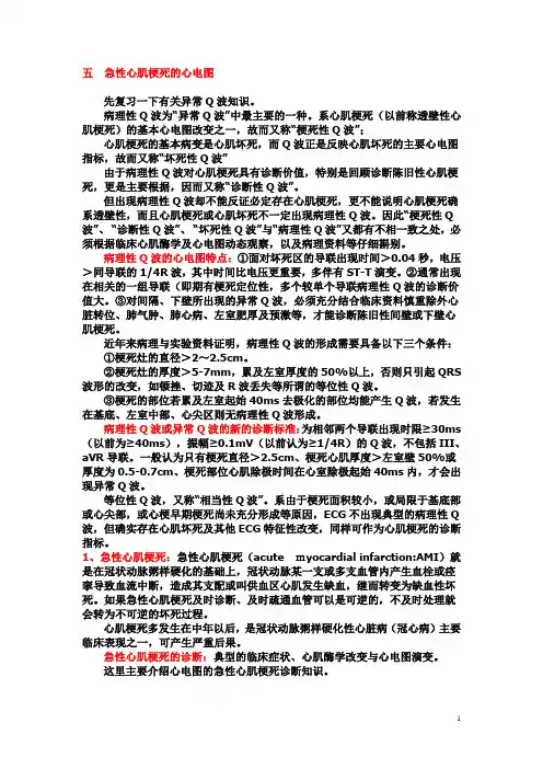另类心电图讲义-13--心肌梗死心电图诊断