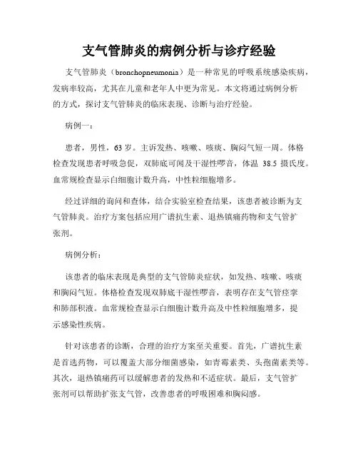 支气管肺炎的病例分析与诊疗经验