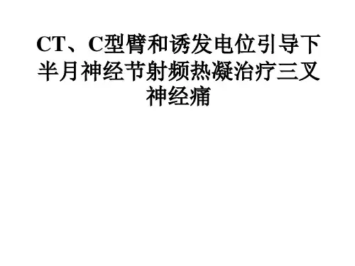 【医学PPT课件】CT和诱发电位引导下半月神经节射频热凝术治疗三叉神经痛