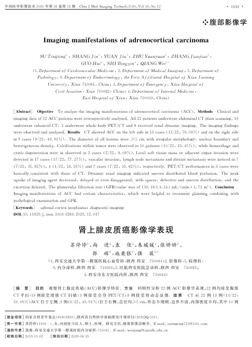 肾上腺皮质癌影像学表现