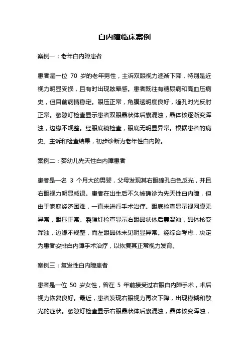 白内障临床案例