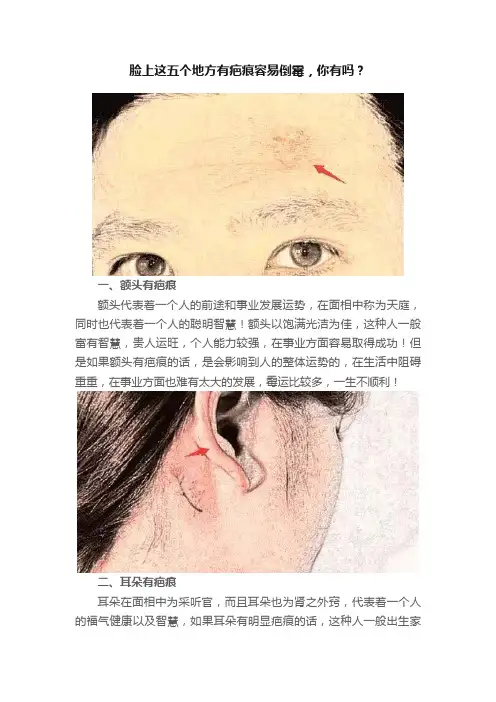 脸上这五个地方有疤痕容易倒霉，你有吗？