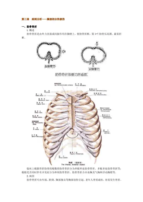 第三章 病例分析——胸部闭合性损伤