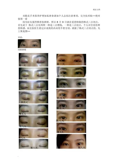 双眼皮手术术后护理注意事项,术前准备,术后食谱