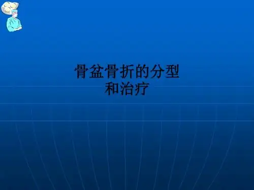 骨盆骨折的分型和治疗ppt课件