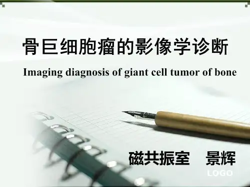 骨巨细胞瘤 PPT课件
