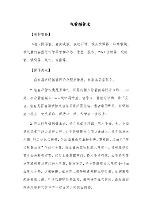 气管插管术