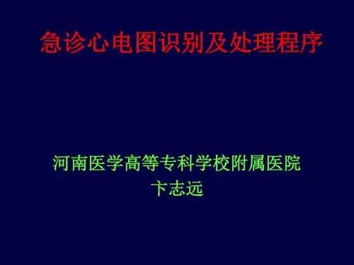 急诊心电图识别及处理程序