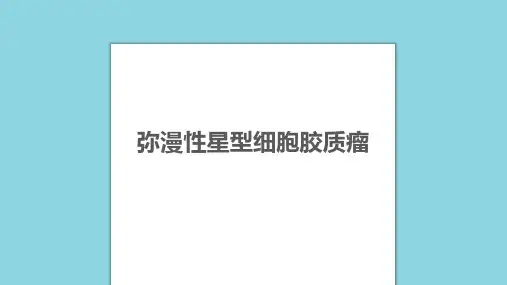 弥漫性星形细胞瘤影像