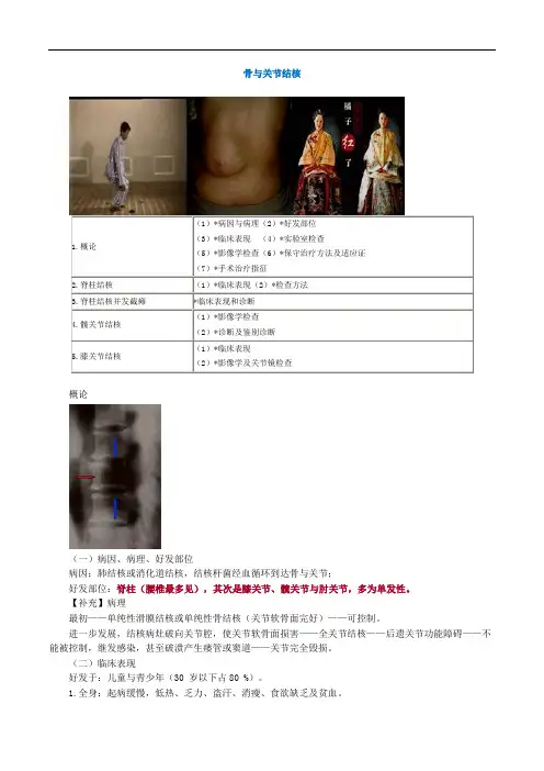 医学课件---骨与关节结核
