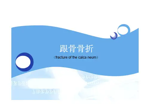 跟骨骨折
