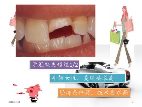 口腔修复病例 ppt课件