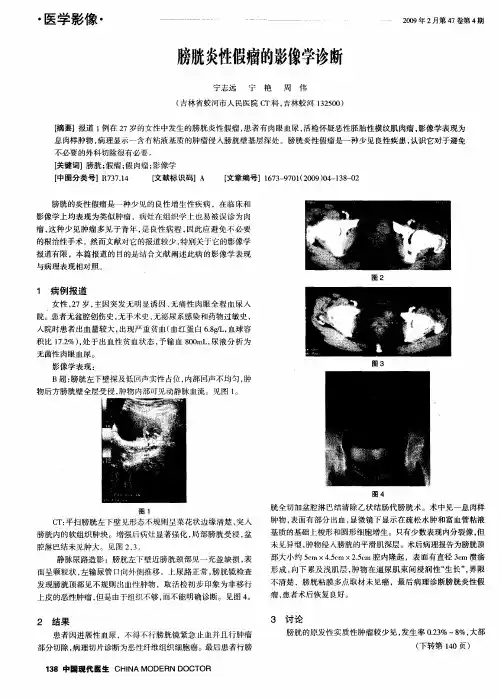 膀胱炎性假瘤的影像学诊断