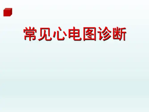 常见心电图诊断【111页】