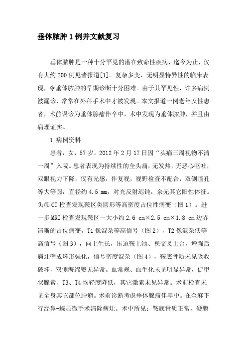 垂体脓肿1例并文献复习-最新文档