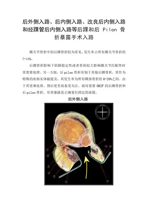 后外侧入路、后内侧入路、改良后内侧入路和经踝管后内侧入路等后踝和后 Pilon 骨折暴露手术入路