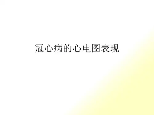冠心病的心电图表现