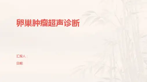 卵巢肿瘤超声诊断