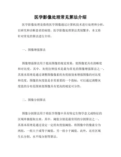 医学影像处理常见算法介绍