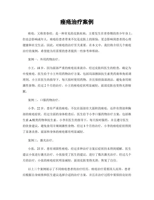 痤疮治疗案例
