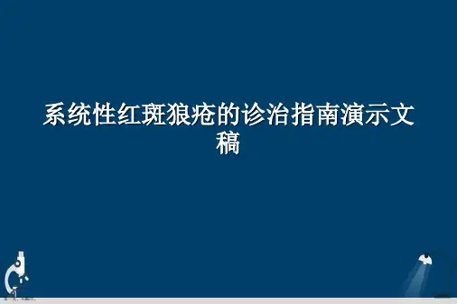 系统性红斑狼疮的诊治指南演示文稿