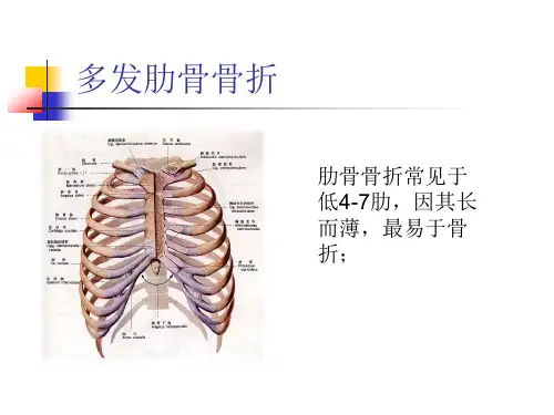 肋骨骨折合并血气胸的护理