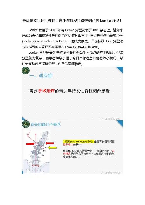 骨科精读手把手教程：青少年特发性脊柱侧凸的Lenke分型！