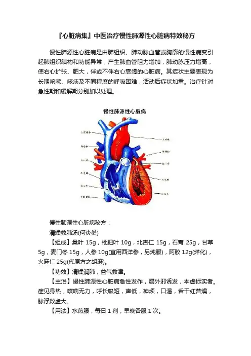 『心脏病集』中医治疗慢性肺源性心脏病特效秘方