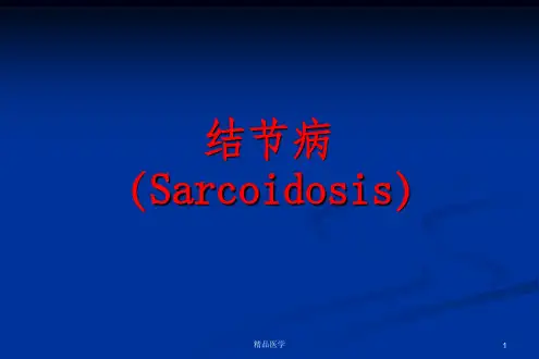 《结节病讲》PPT课件
