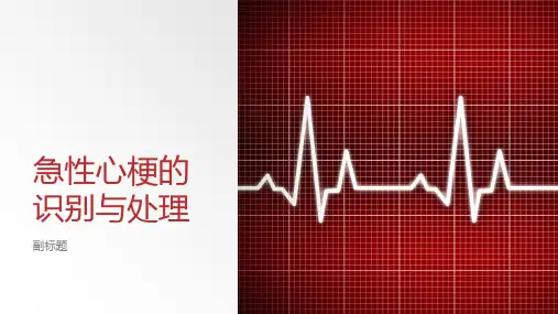 急性心梗的识别与处理
