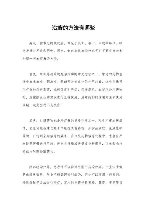 治癣的方法有哪些
