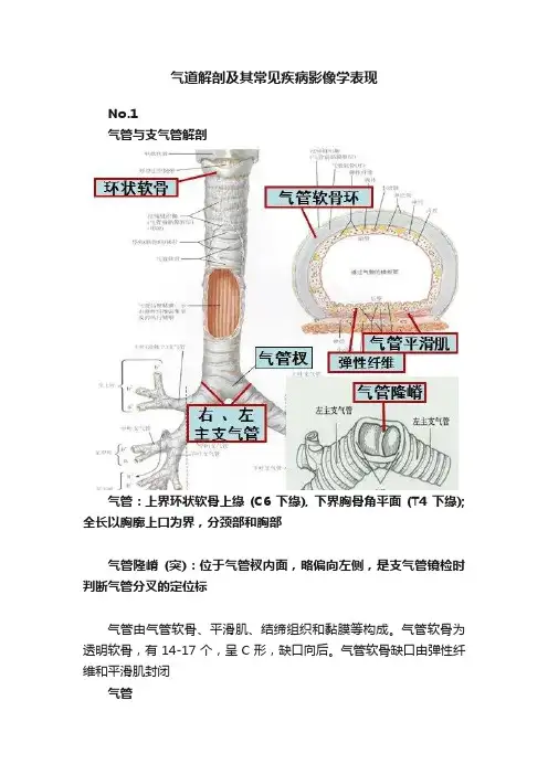 气道解剖及其常见疾病影像学表现