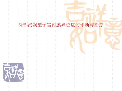 深部浸润型子宫内膜异位症的诊断与治疗