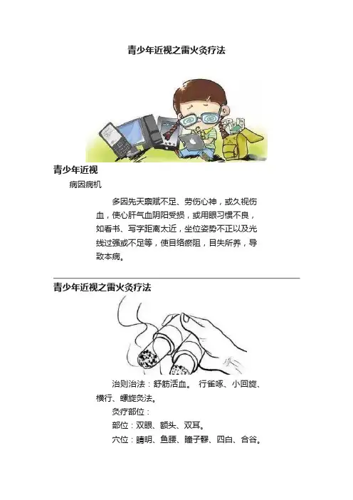 青少年近视之雷火灸疗法