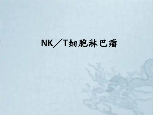 NK／T细胞淋巴瘤ppt课件