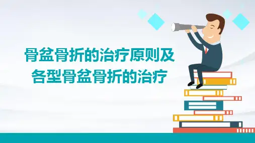 骨盆骨折的治疗原则及各型骨盆骨折的治疗