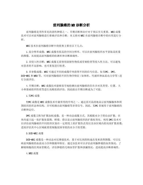 前列腺癌的MR诊断分析