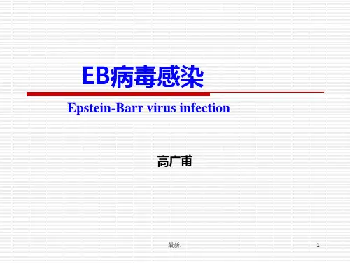 学习资料EB病毒感染2017.ppt