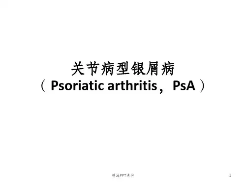 关节病型银屑病ppt课件