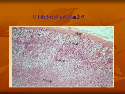 嗜铬细胞瘤诊治的进展