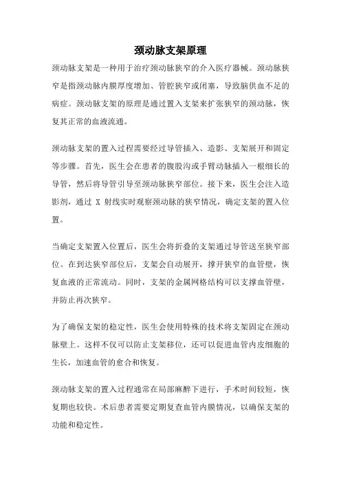 颈动脉支架原理