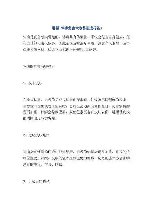 警惕 体癣危害大容易造成传染？
