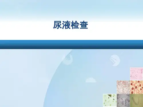 诊断学基础课件--尿液检查课件