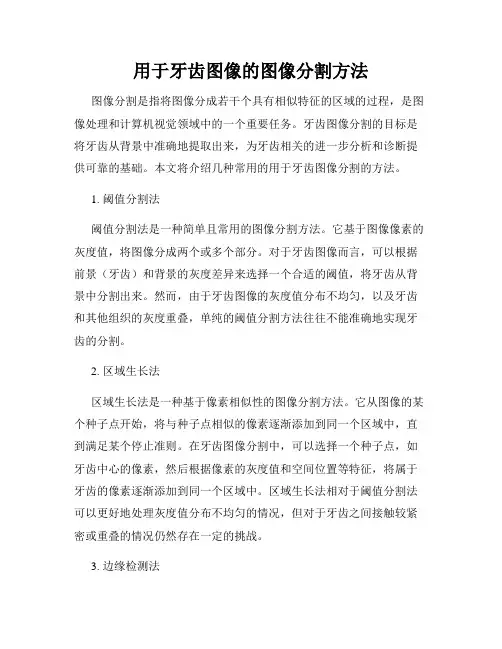 用于牙齿图像的图像分割方法