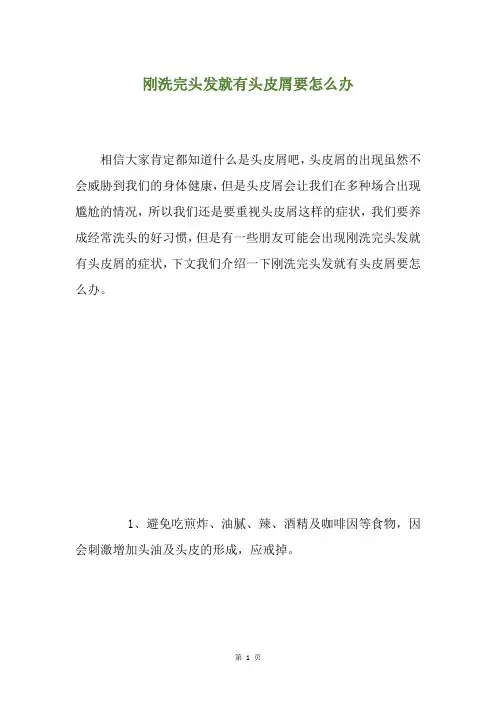 刚洗完头发就有头皮屑要怎么办
