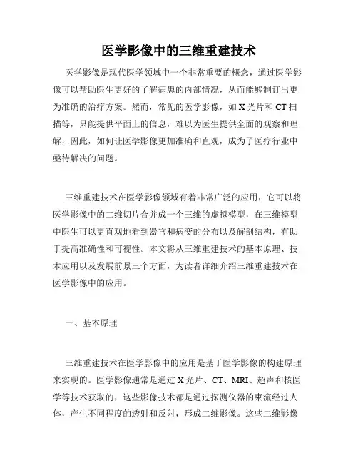 医学影像中的三维重建技术