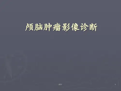 胶质瘤影像诊断PPT课件