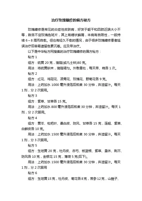 治疗玫瑰糠疹的偏方秘方
