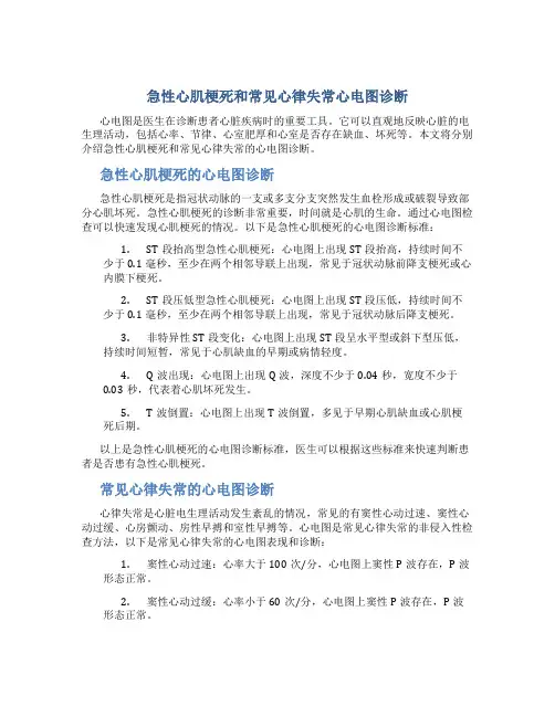 急性心肌梗死和常见心律失常心电图诊断