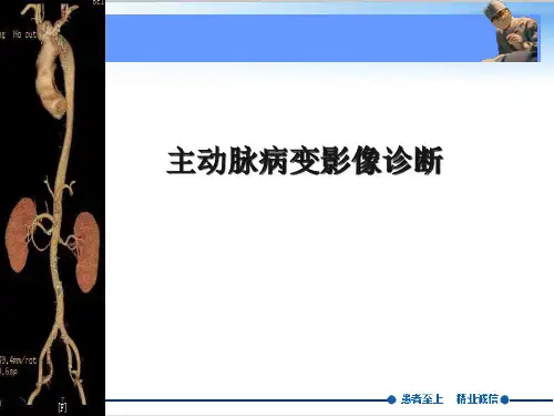 主动脉夹层、壁间血肿及穿通性溃疡